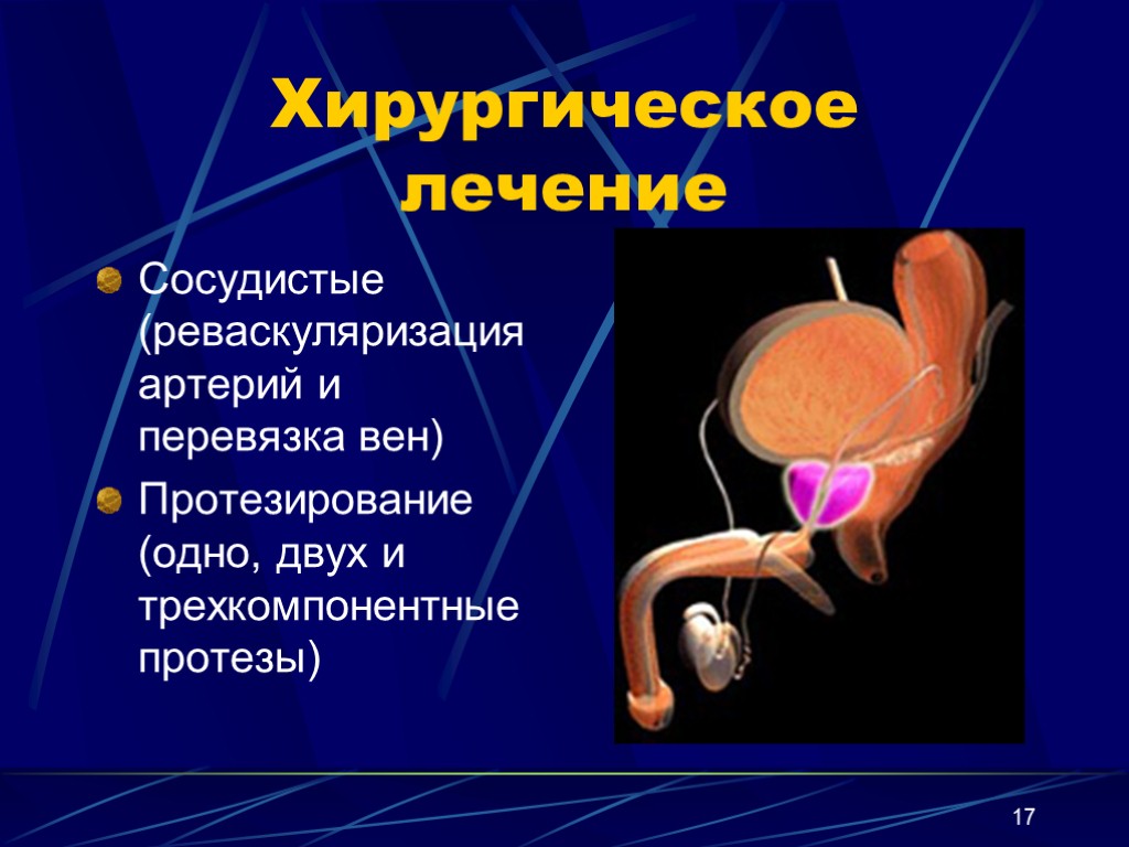 Эректильная дисфункция что это такое