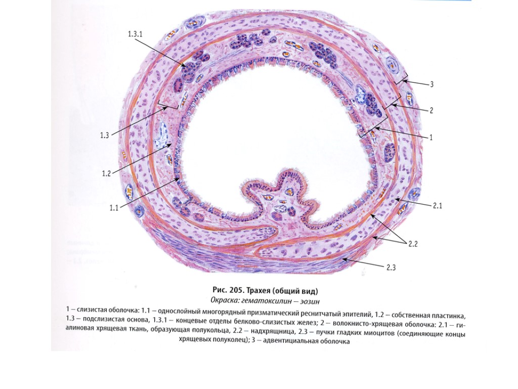 Трахея клетки. Трахея поперечный срез гистология. Строение стенки трахеи гистология. Стенка трахеи гистология. Строение трахеи гистология препарат.