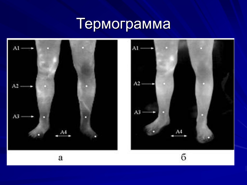 Схема лечения облитерирующего атеросклероза нижних конечностей