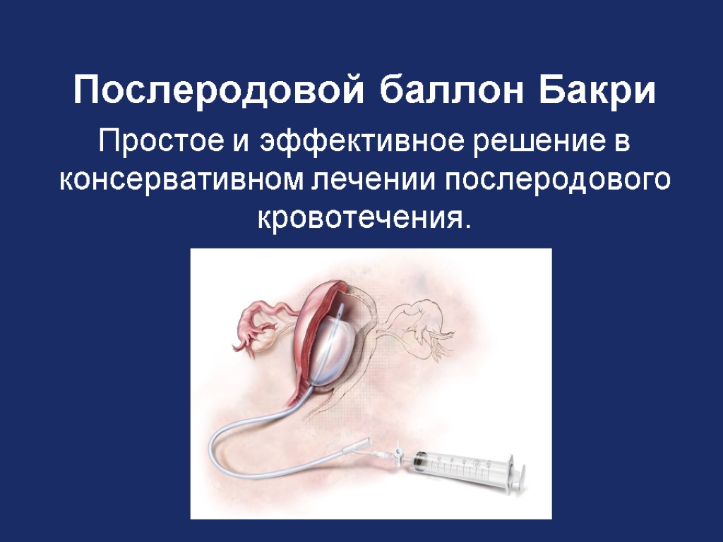 Послеродовое кровотечение. Послеродовое кровотечение презентация. Послеродовые кровотечения ppt. Послеродовые кровотечения памятка.