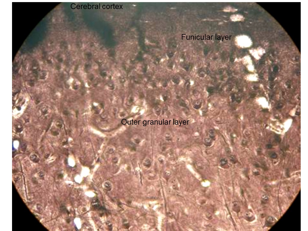 Outer granular layer Cerebral cortex Funicular layercerebrum Internal