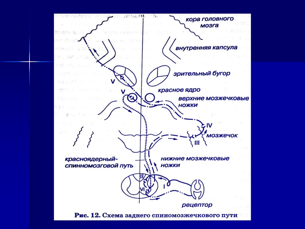 Красноядерно спинномозговой путь схема