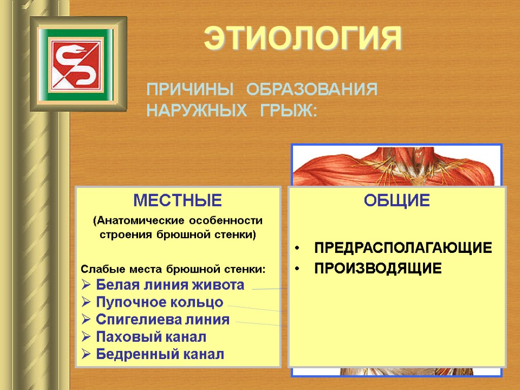 Грыжа брюшной стенки. Предпосылки образования грыж. Маста образования грыж. Слабые места образования грыж. Этиология грыж живота.