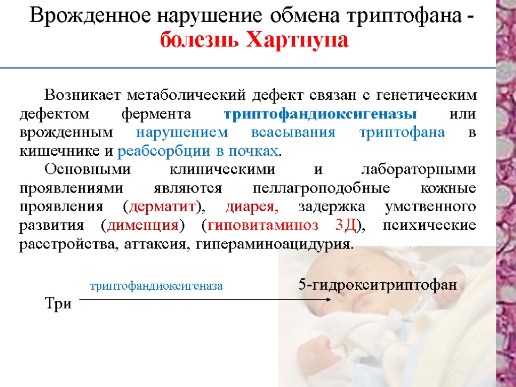 Болезни нарушения аминокислот. Болезнь Хартнупа биохимия. Врожденные нарушения обмена триптофана. Наследственные нарушения обмена триптофана. Обмен триптофана.