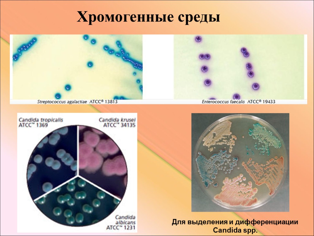 Агалактия. Хромогенные питательные среды микробиология. Хромогенные среды микробиология примеры. Хромогенные питательные среды примеры. Candida на питательных средах.