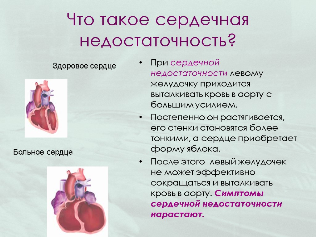 Заболевание сердца сопровождающееся сердечной недостаточностью. Сердечная недостаточность. Сердечна янедостатояность. Сесердечная недостаточность это. Сердце при острой сердечной недостаточности.