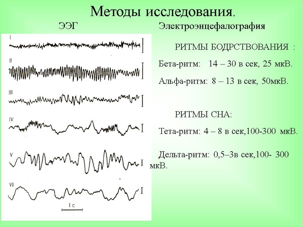 Регистрация активности мозга. Частотный диапазон Альфа ритма на ЭЭГ. ЭЭГ Альфа бета тета Дельта ритмы. Норма бета ритма на ЭЭГ. Альфа ритм на ЭЭГ норма.