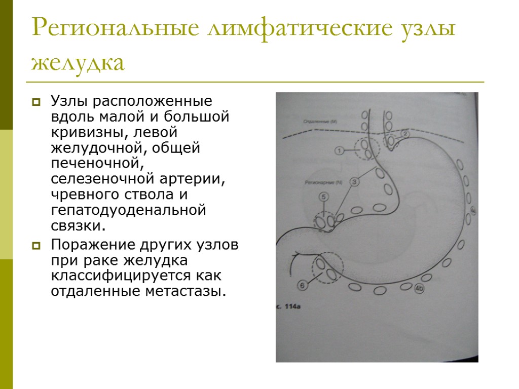 Лимфатические узлы желудка схема