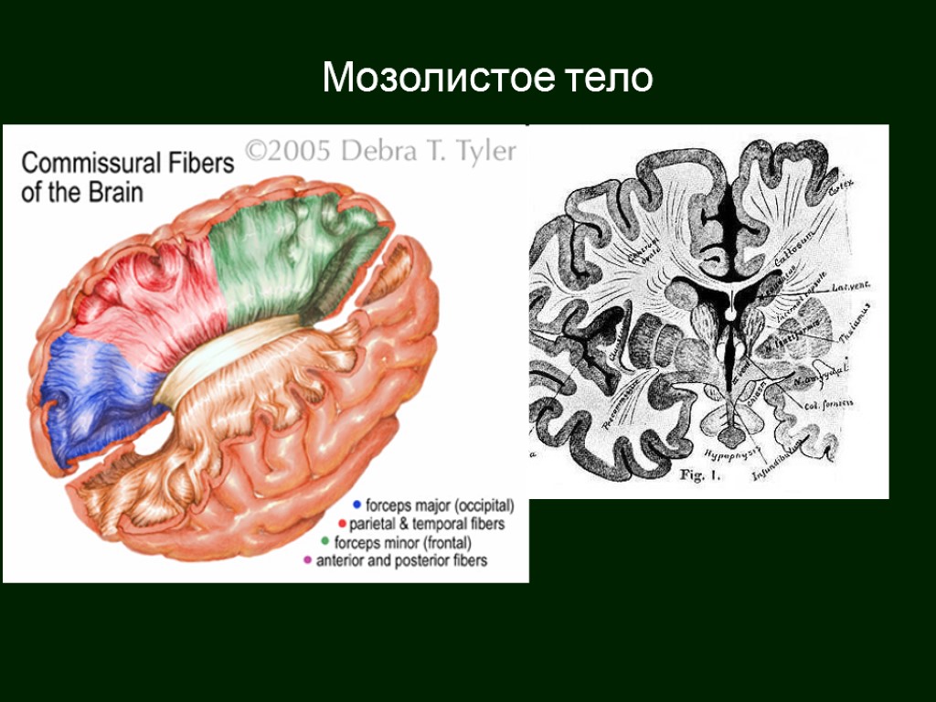 Мозолистое тело расположено