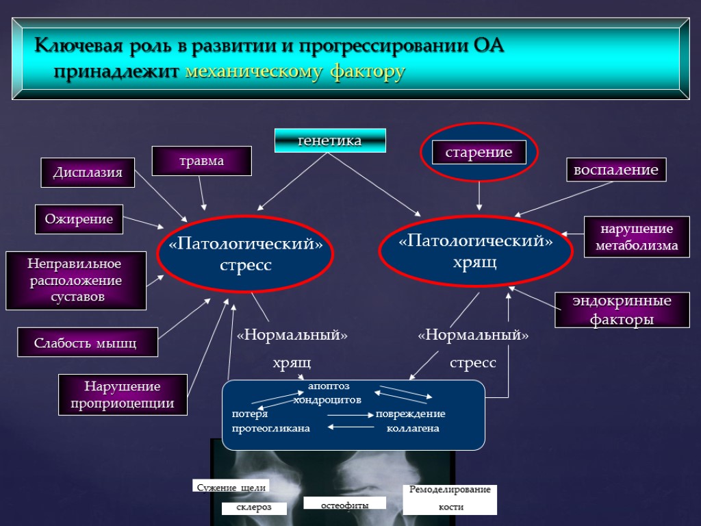 Подагра патогенез