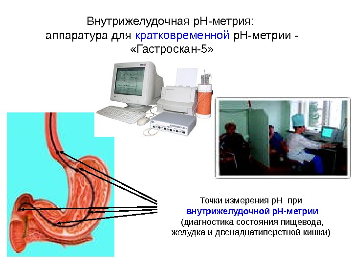Точки измерения р. Н при внутрижелудочной p. H-метрии  (диагностика состояния пищевода,  желудка и двенадцатиперстной
