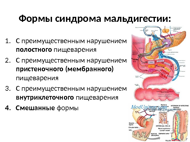 Формы синдрома мальдигестии: 1. С преимущественным нарушением полостного пищеварения 2. С преимущественным нарушением пристеночного (мембранного) 