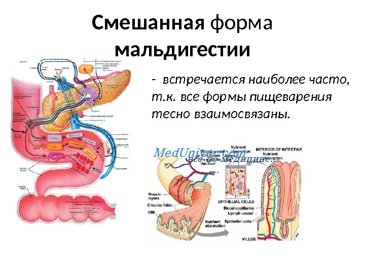 Смешанная форма мальдигестии - встречается наиболее часто,  т. к. все формы пищеварения тесно взаимосвязаны. 