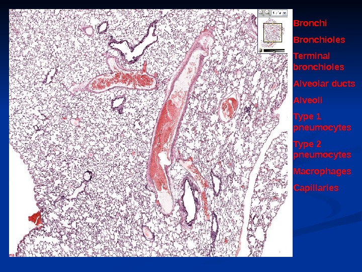 Bronchioles Terminal bronchioles Alveolar ducts Alveoli Type 1 pneumocytes Type 2 pneumocytes Macrophages Capillaries 