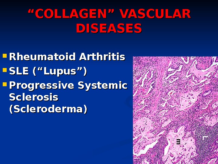 ““ COLLAGEN” VASCULAR DISEASES Rheumatoid Arthritis SLE (“Lupus”) Progressive Systemic Sclerosis (Scleroderma) 
