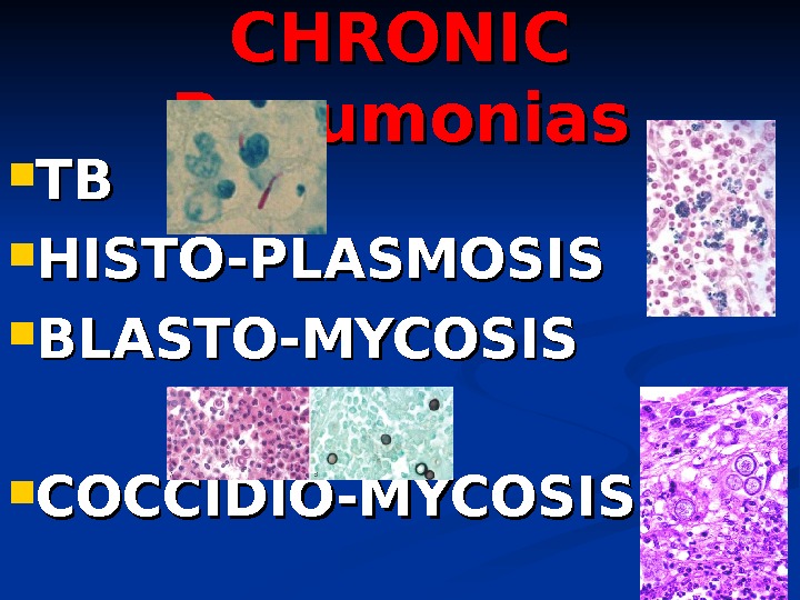 CHRONIC Pneumonias TBTB HISTO-PLASMOSIS BLASTO-MYCOSIS COCCIDIO-MYCOSIS 