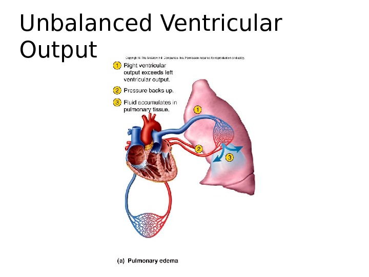 Unbalanced Ventricular Output 