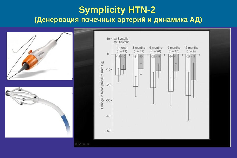 Symplicity HTN-2 ( Денервация почечных артерий и динамика АД) 