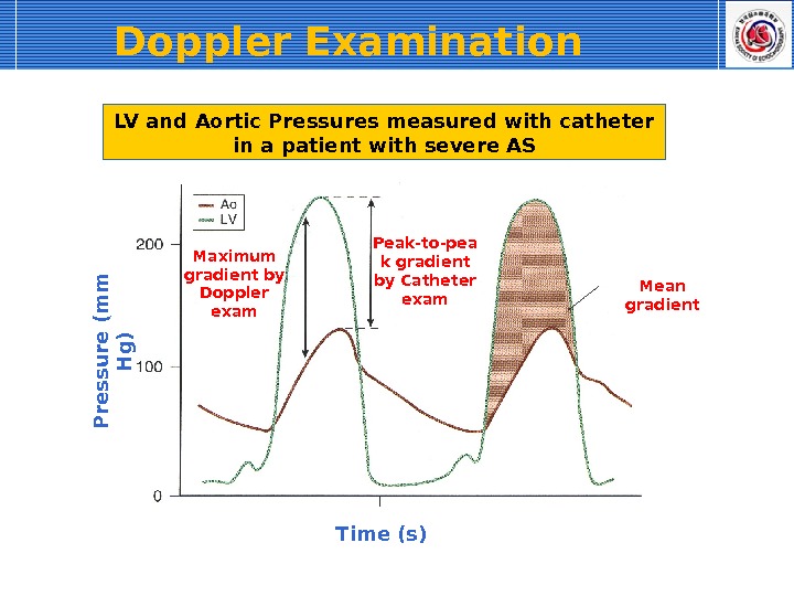 Doppler Examination  Time (s)P re s s u re (m m  H g )Maximum
