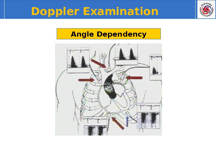 Angle Dependency. Doppler Examination  