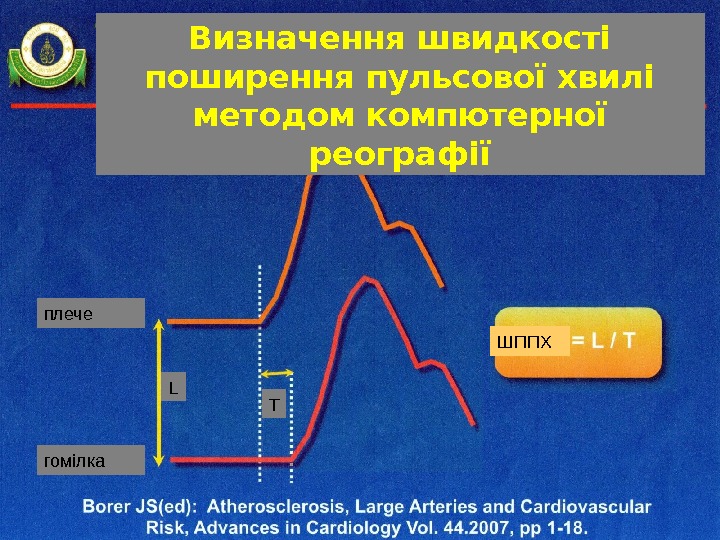 Визначення швидкості поширення пульсової хвилі методом компютерної реографії ШППХплече гомілка ТL 