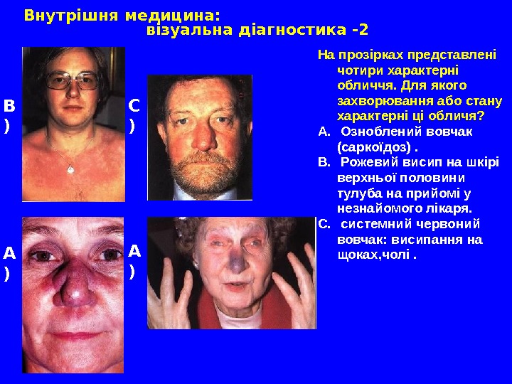   Внутрішня медицина: візуальна діагностика -2 В ) А ) С ) На прозірках представлені