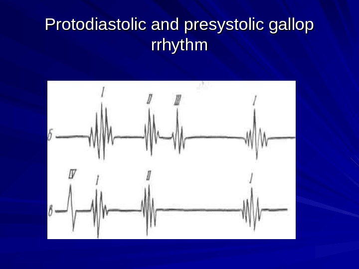  Protodiastolic and presystolic gallop rrhythm 