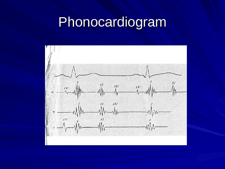  Phonocardiogram 
