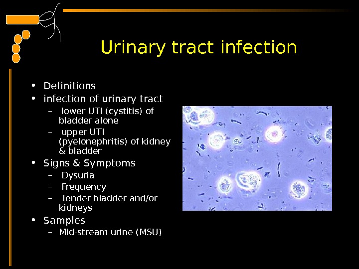  Urinary tract infection • Definitions  • infection of urinary tract –  lower UTI