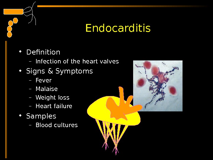  Endocarditis • Definition – Infection of the heart valves  • Signs & Symptoms –