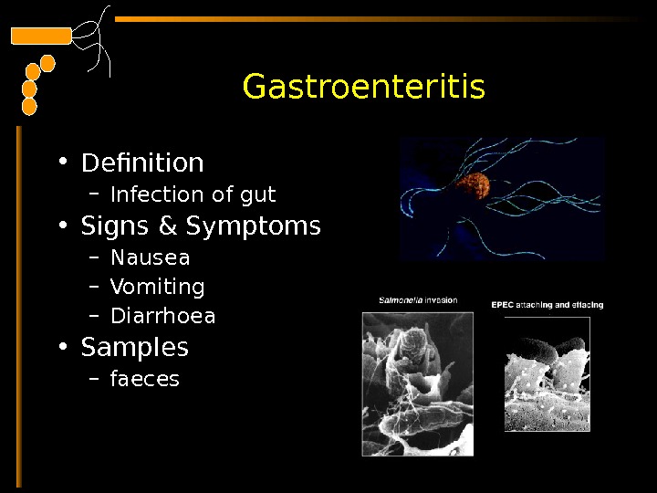  Gastroenteritis • Definition – Infection of gut  • Signs & Symptoms – Nausea –