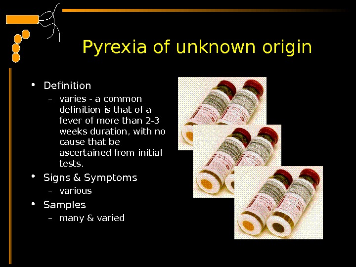  Pyrexia of unknown origin • Definition – varies - a common definition is that of