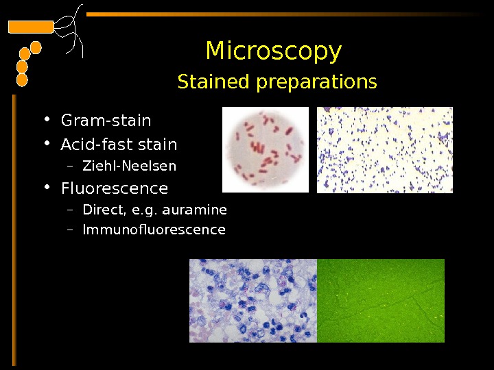  Microscopy  Stained preparations • Gram-stain • Acid-fast stain – Ziehl-Neelsen • Fluorescence – Direct,