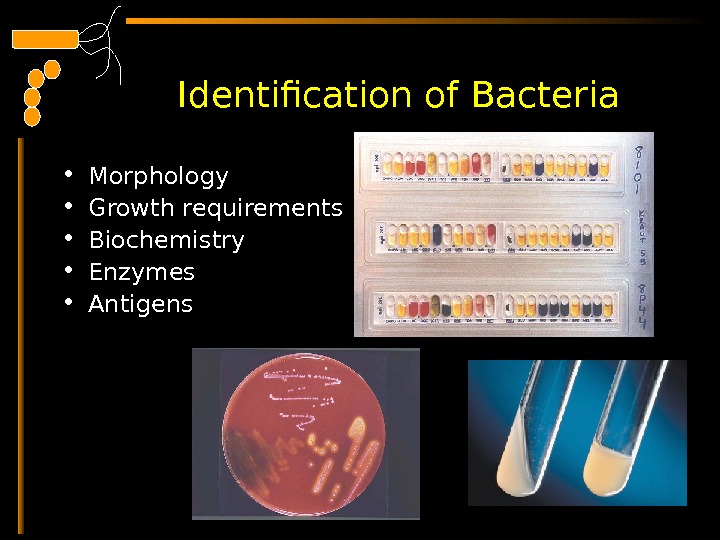  Identification of Bacteria • Morphology • Growth requirements • Biochemistry • Enzymes • Antigens 