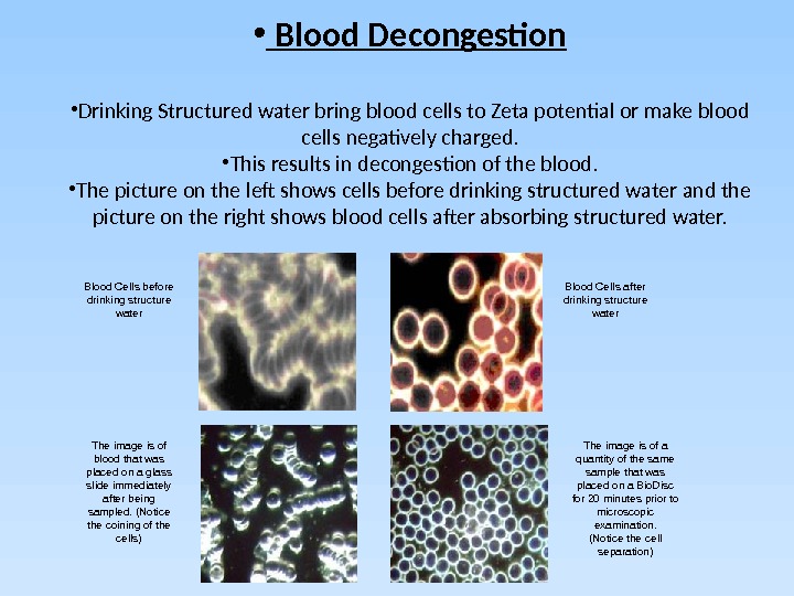 •  Blood Decongestion • Drinking Structured water bring blood cells to Zeta potential or