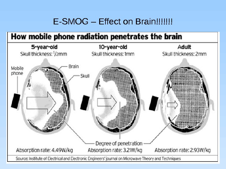 E-SMOG – Effect on Brain!!!!!!! 