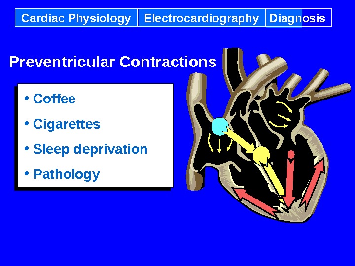 Cardiac Physiology Electrocardiography Diagnosis Preventricular Contractions • Coffee • Cigarettes • Sleep deprivation • Pathology 