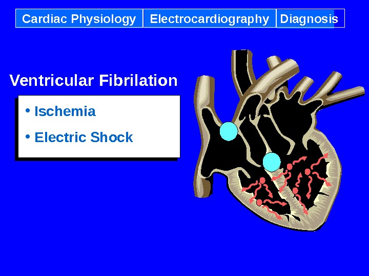 Cardiac Physiology Electrocardiography Diagnosis Ventricular Fibrilation • Ischemia • Electric Shock 