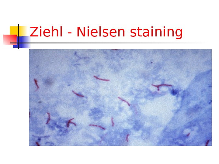 Ziehl - Nielsen staining 