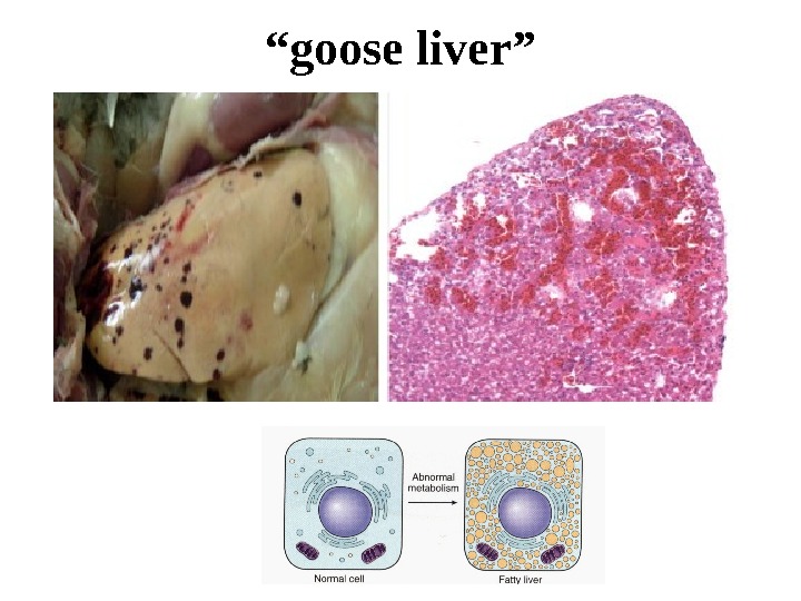 “ goose liver” 