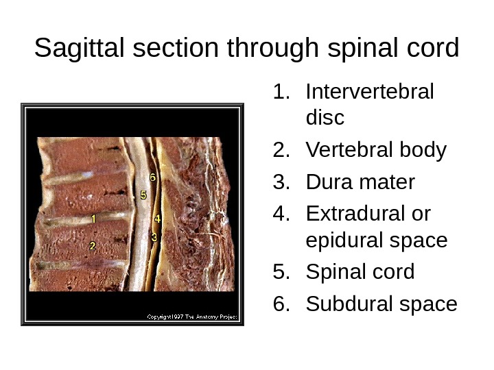 Sagittal section through spinal cord 1. Intervertebral disc 2. Vertebral body 3. Dura mater 4. Extradural