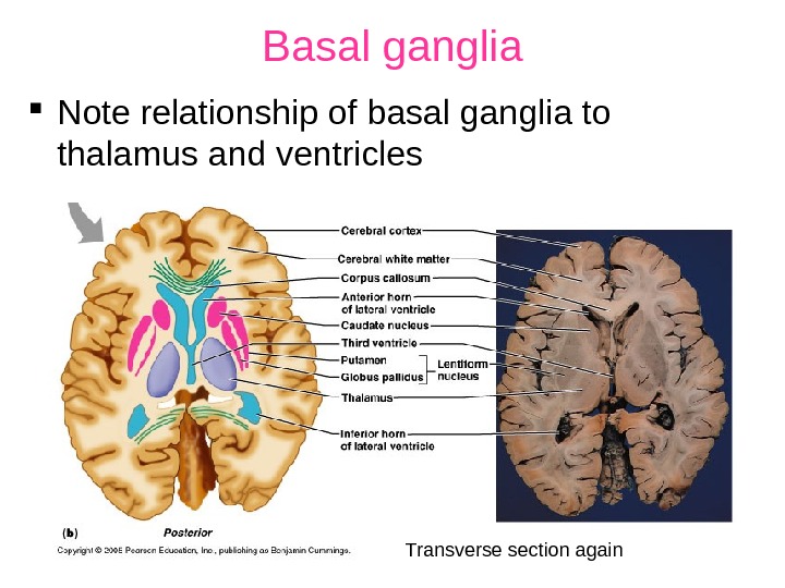 Basal ganglia Note relationship of basal ganglia to thalamus and ventricles Transverse section again 