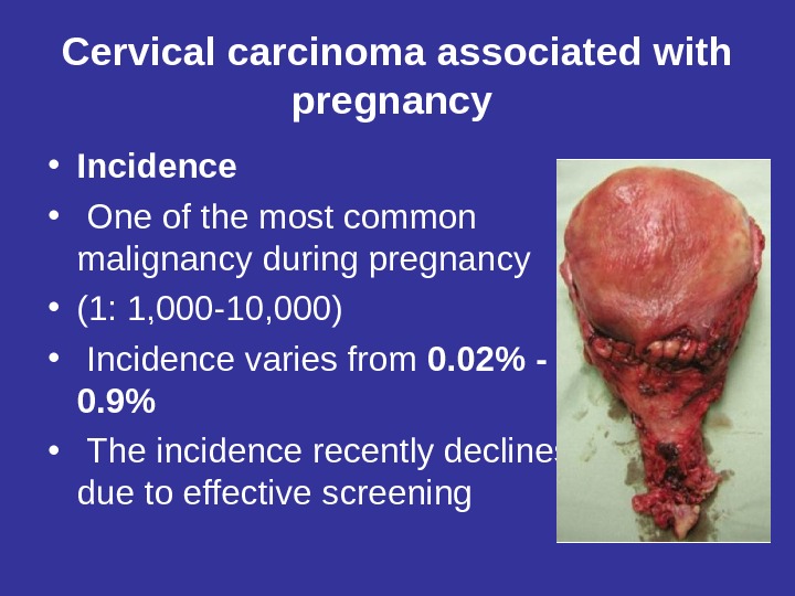 Cervical carcinoma associated with pregnancy  • Incidence •  One of the most common malignancy