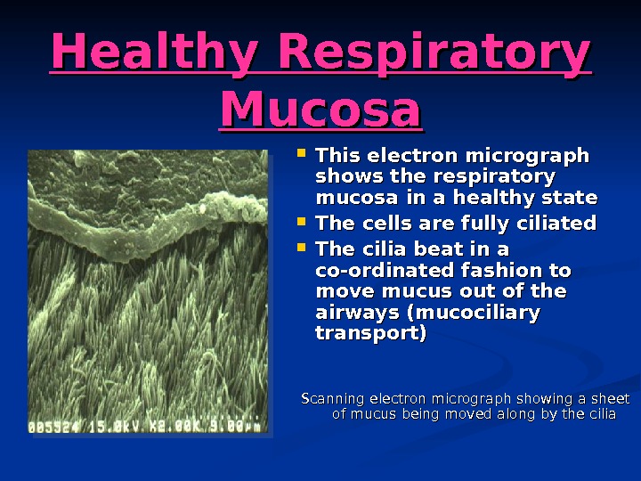   Healthy Respiratory Mucosa This electron micrograph shows the respiratory mucosa in a healthy state