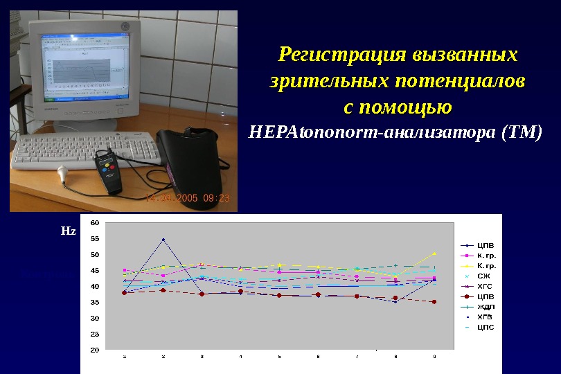 Регистрация вызванных зрительных потенциалов с помощью НЕРА tononorm -анализатора (ТМ) Hz Hz Контроль 