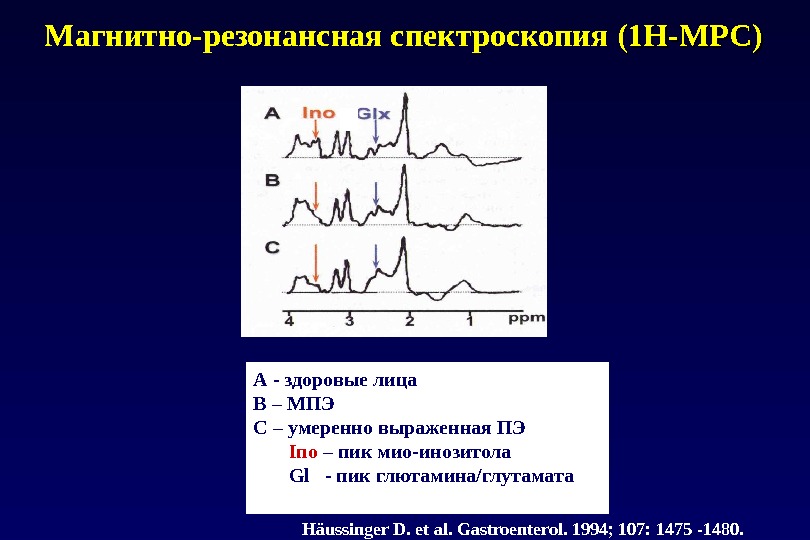 Магнитно-резонансная спектроскопия (1H-МРС) А - здоровые лица В – МПЭ С – умеренно выраженная ПЭ 