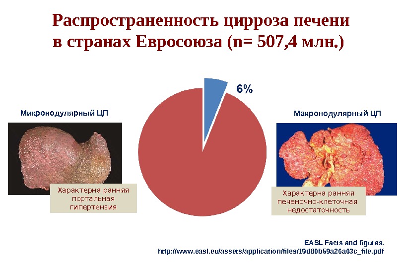 EASL Facts and figures.  http: //www. easl. eu/assets/application/files/19d 80b 59a 26a 03c_file. pdf. Распространенность цирроза