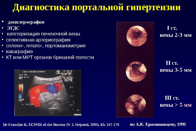Диагностика портальной гипертензии  • допплерография • ЭГДС • катетеризация печеночной вены  • селективная артериография