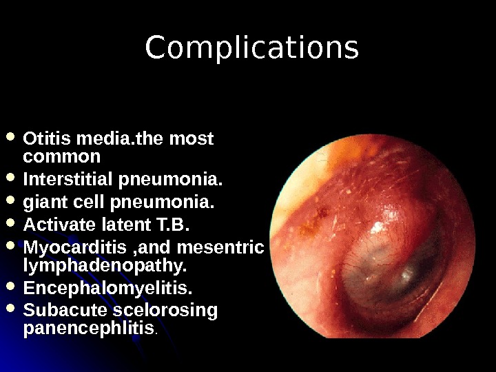   Complications Otitis media. the most common Interstitial pneumonia.  giant cell pneumonia.  Activate