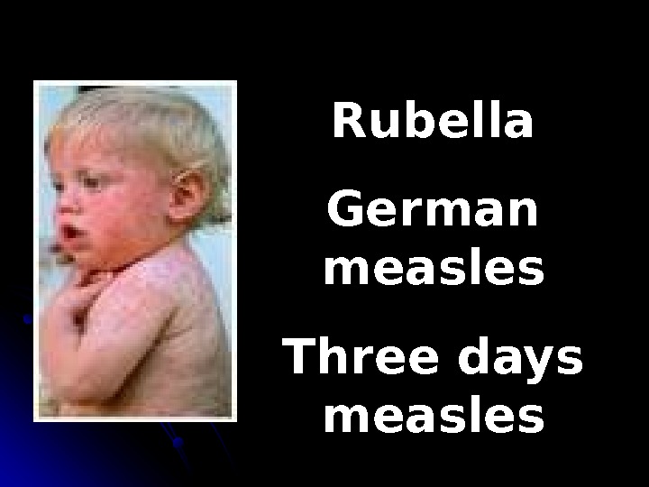   Rubella German measles Three days measles 